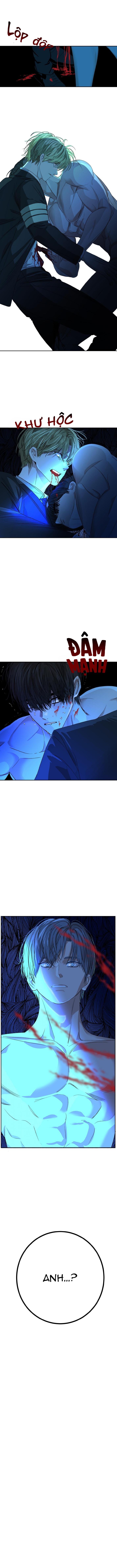 Tuyển Tập Manhwa Dằm Khăm Chapter 80 -Tôi chết 4 11