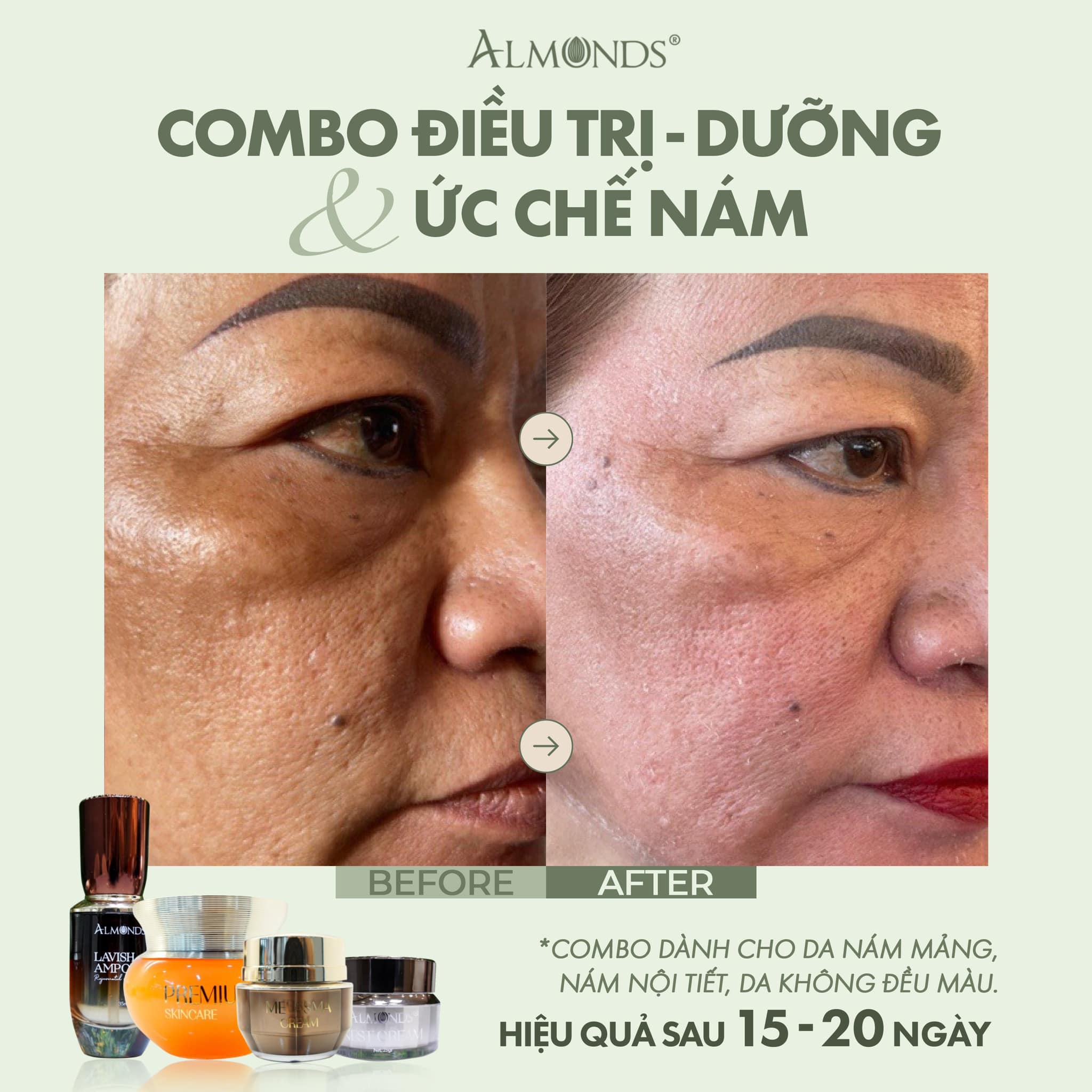 Combo 2 Trắng Da Ngừa Nám Almonds 2 Món