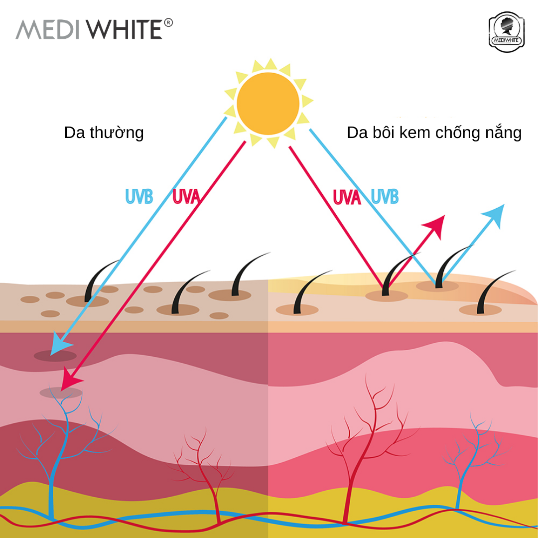 Kem chống nắng nâng tông Medi White mỏng nhẹ bảo vệ da khỏi kích ứng ngừa nám da và tàn nhang