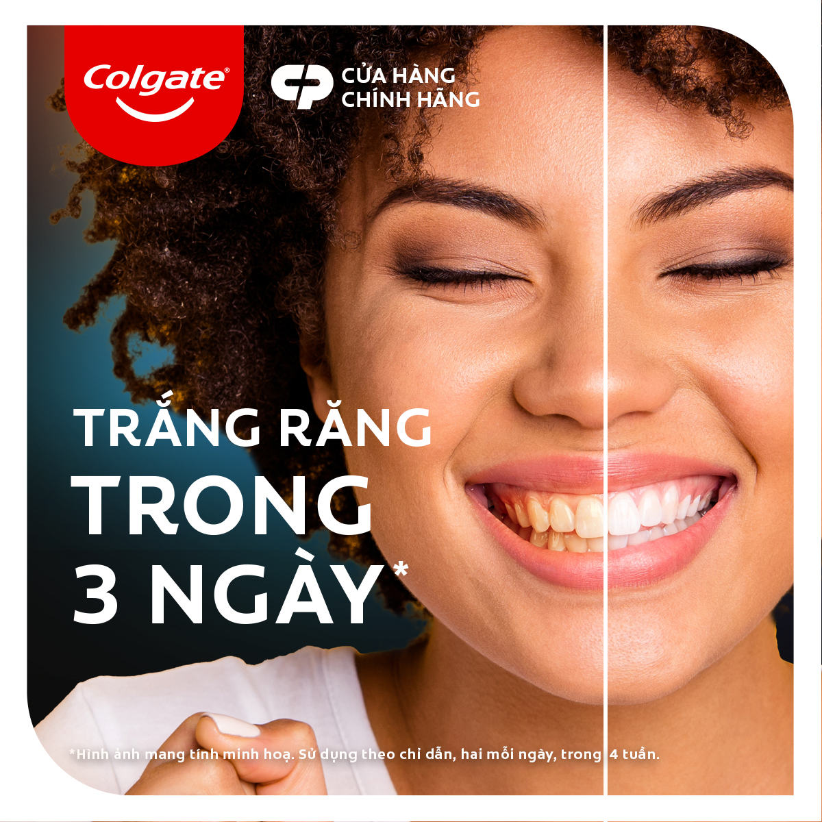 Kem Đánh Răng Colgate Optic White O2 với Oxy Hoạt Tính trắng răng 3 ngày 85g