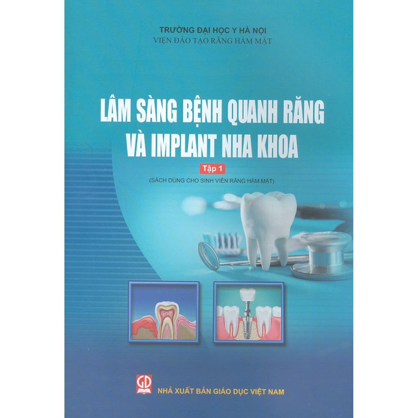 Lâm Sàng Bệnh Quanh Răng Và Implant Nha Khoa - Tập 1 Sách Dùng Cho Sinh Viên Răng Hàm Mặt