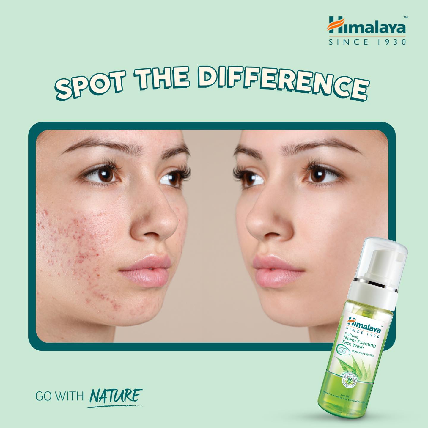 Sữa Rửa Mặt Tạo Bọt Neem Ngừa Mụn Trứng Cá Himalaya Herbals