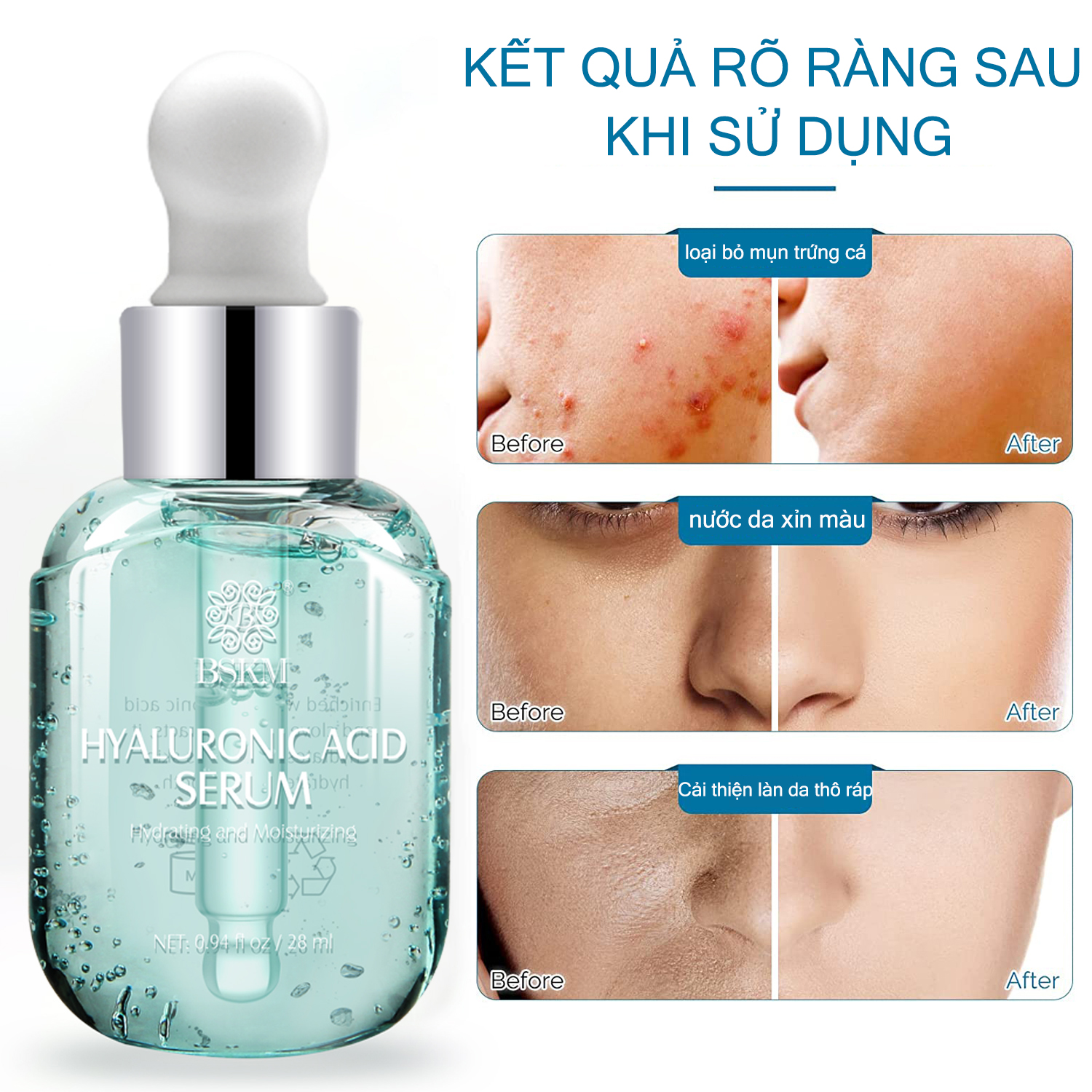 BSKM Hyaluronic Acid Serum Dưỡng Ẩm Dưỡng Trắng Da Giảm Nhăn Chống Lão Hóa Serum 28Ml