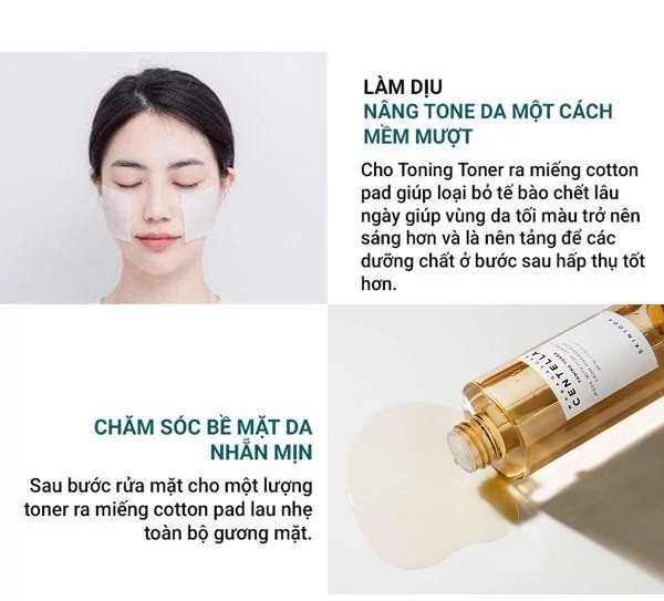 Bộ 4 Sản Phẩm Dưỡng Da Giảm Mụn, Phục Hồi Da Skin1004 Madagascar Centella (Cleansing Foam 125ml + Toner 210ml + Serum 100ml + Cream 75ml) + Tặng Kèm 1 Mặt Nạ Sexylook