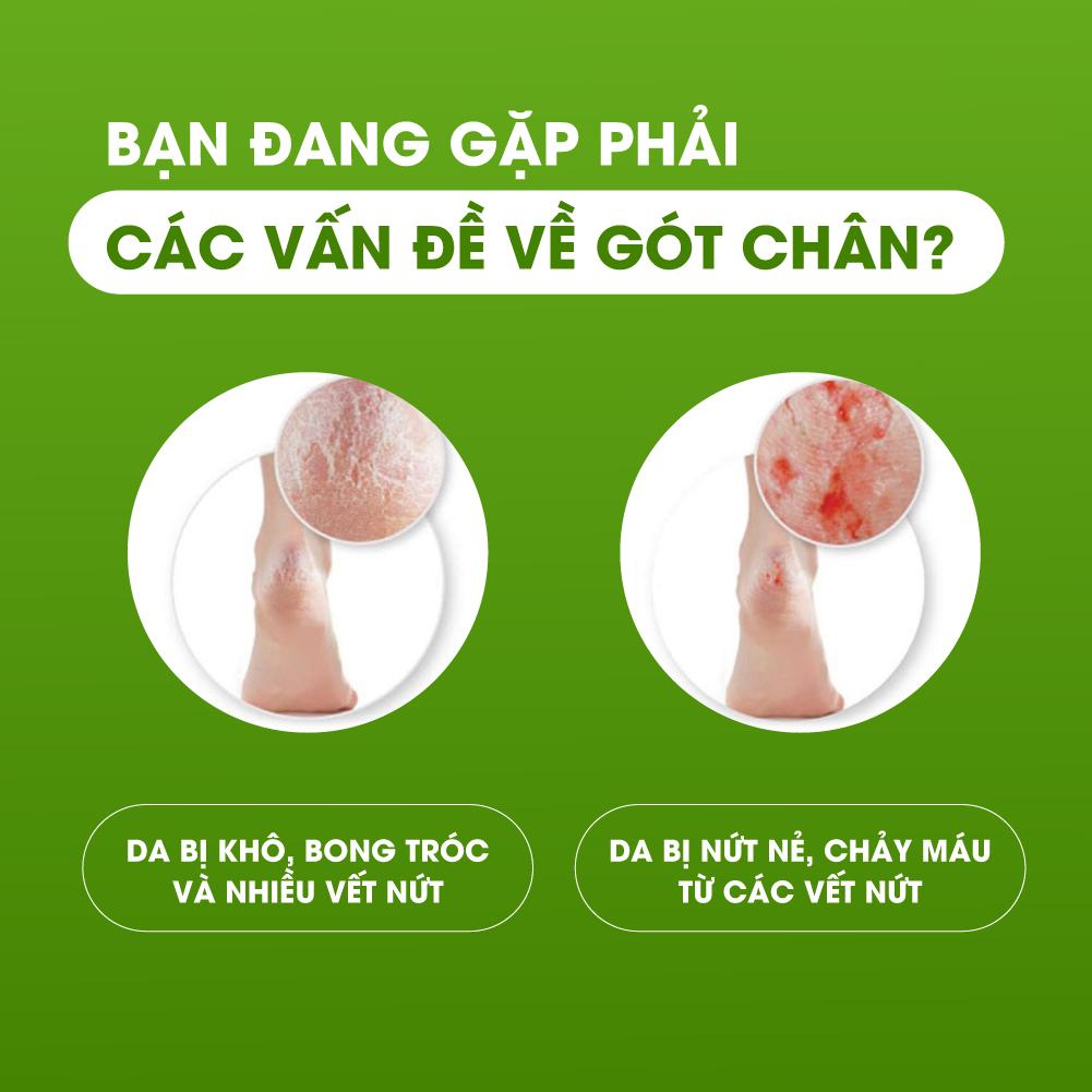 [Hũ 24gr] Kem nứt gót chân Banana Heel Cream