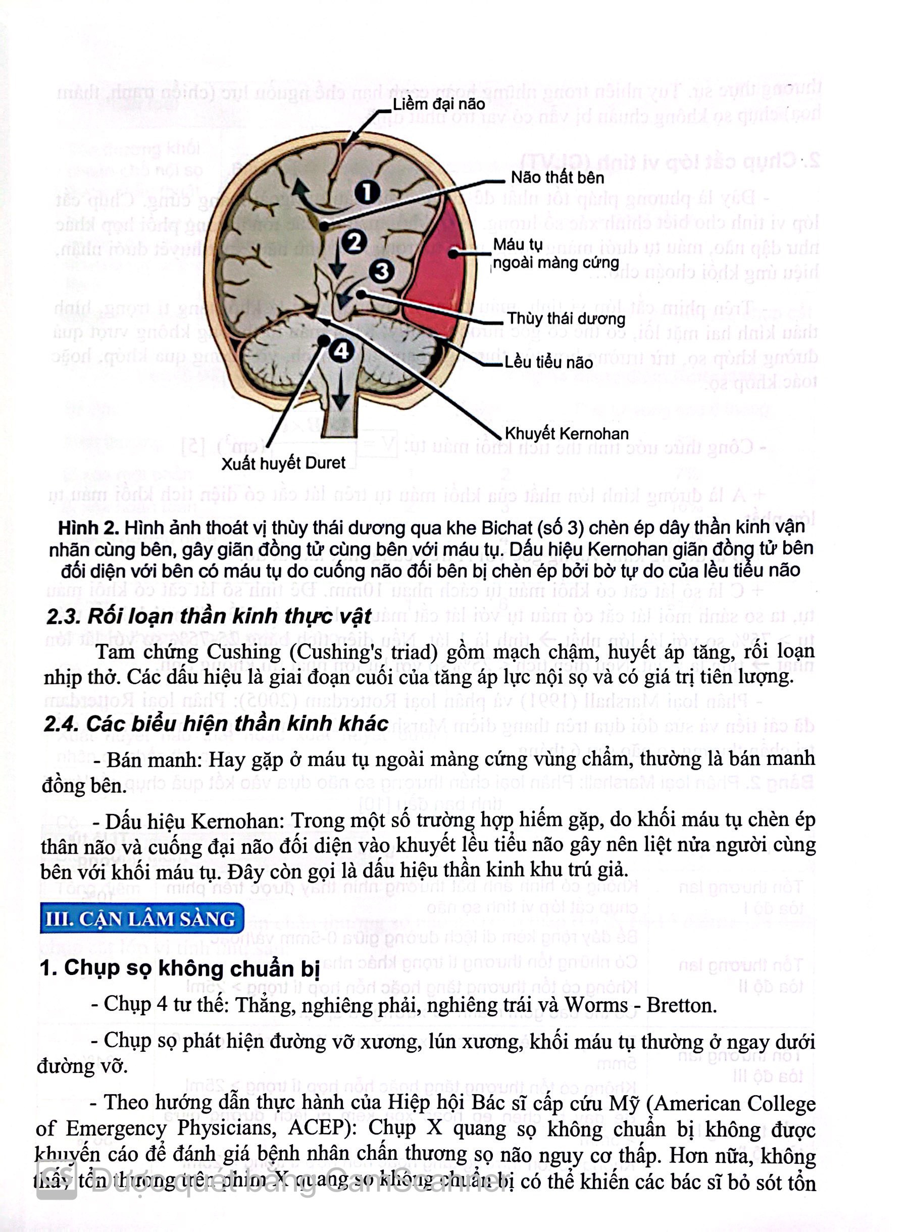 Benito - Sách - Bệnh học ngoại khoa Thần kinh - NXB Y học