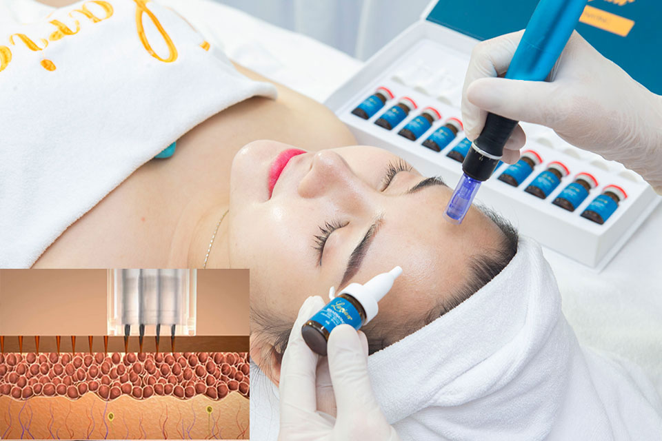 Hộp 10 lọ Tế bào gốc DNA cá hồi hỗ trợ cải thiện sẹo rỗ LARIAN REJUVENATING