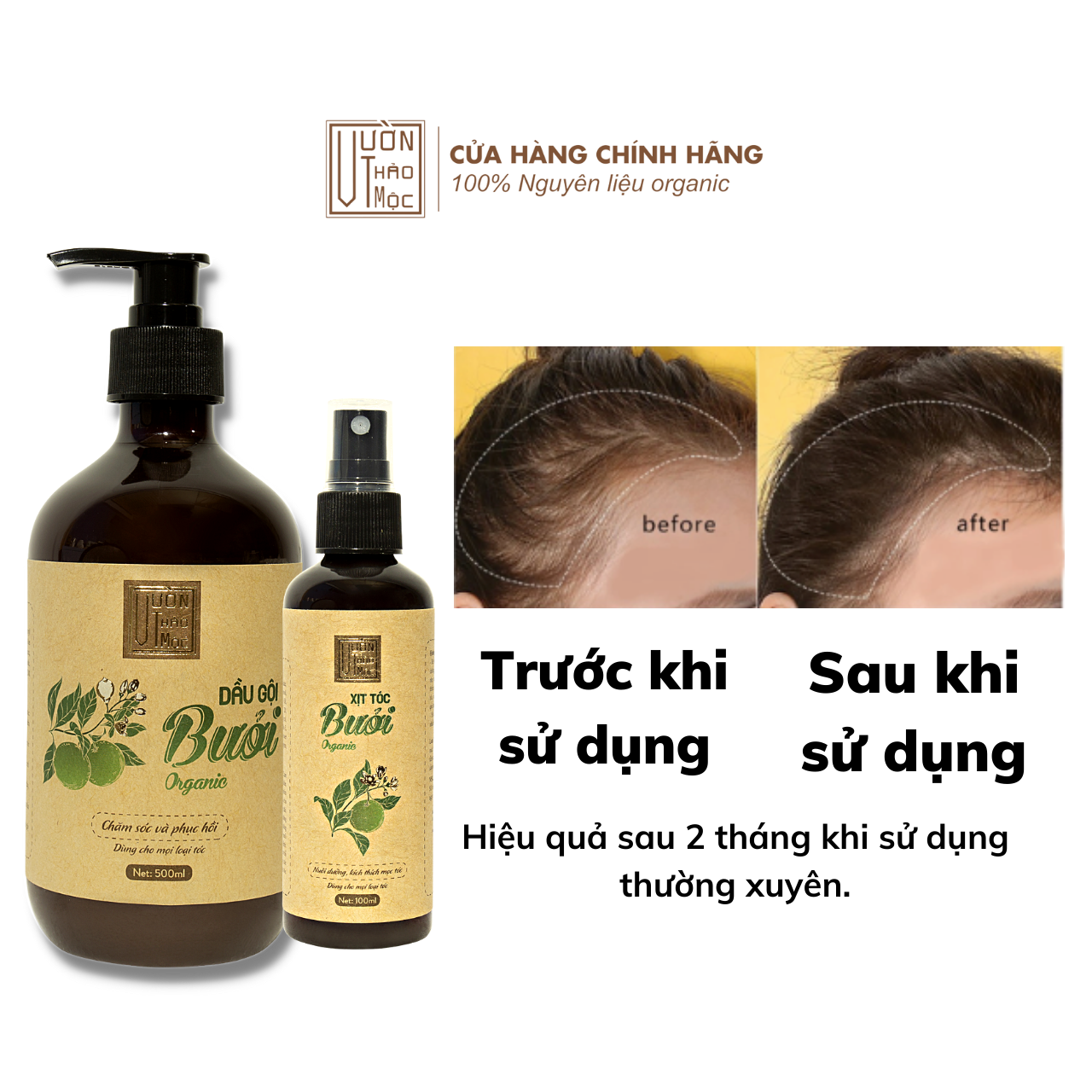 Combo Dầu Gội Bưởi 500ml Xịt Dưỡng Tóc Bưởi 100ml VƯỜN THẢO MỘC ORGANIC Chăm Sóc Tóc Dưỡng Tóc Mọc Dày