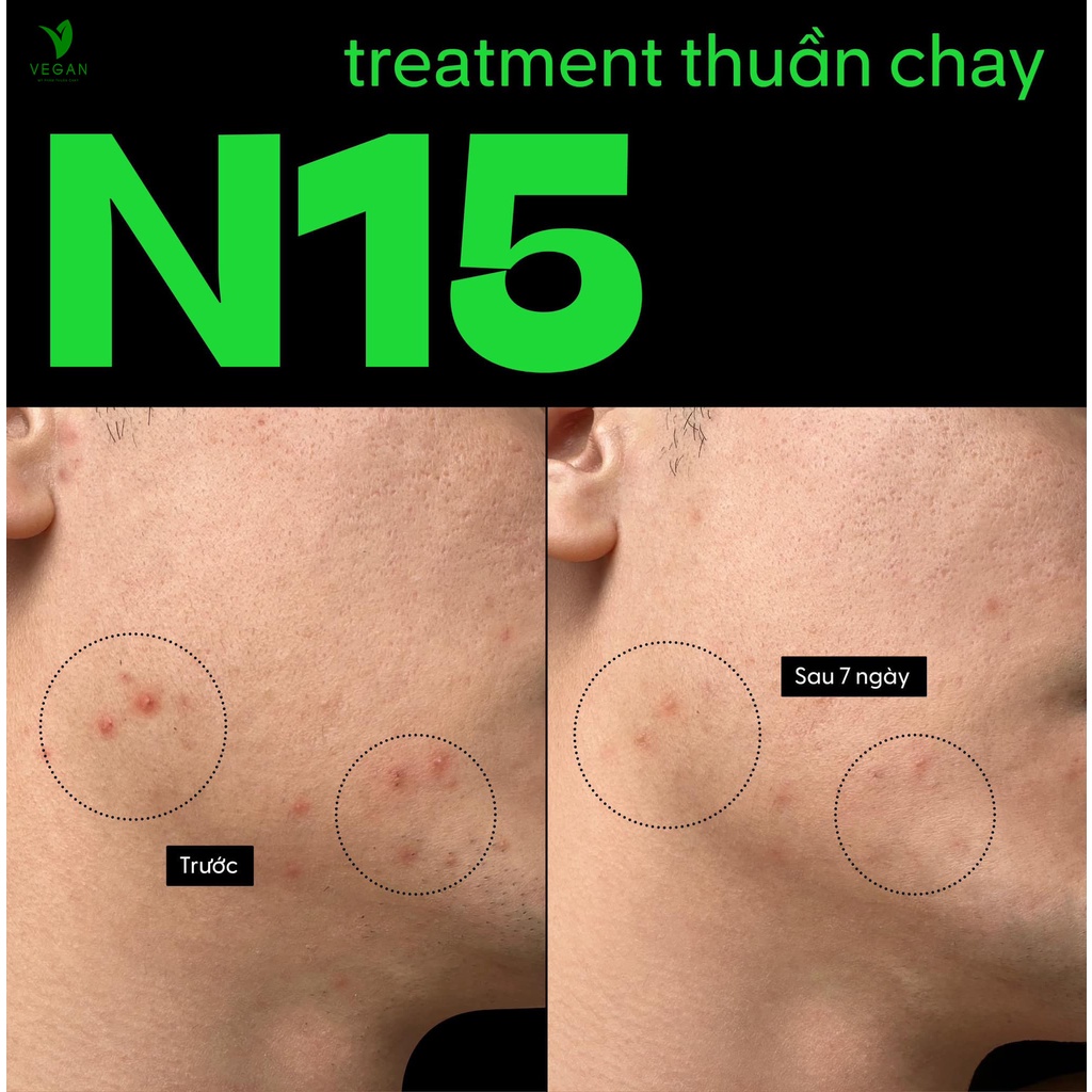 N15 - Serum tinh chất bí đao Cocoon 70ml 15% niacinamide sach mụn Thuần Chay