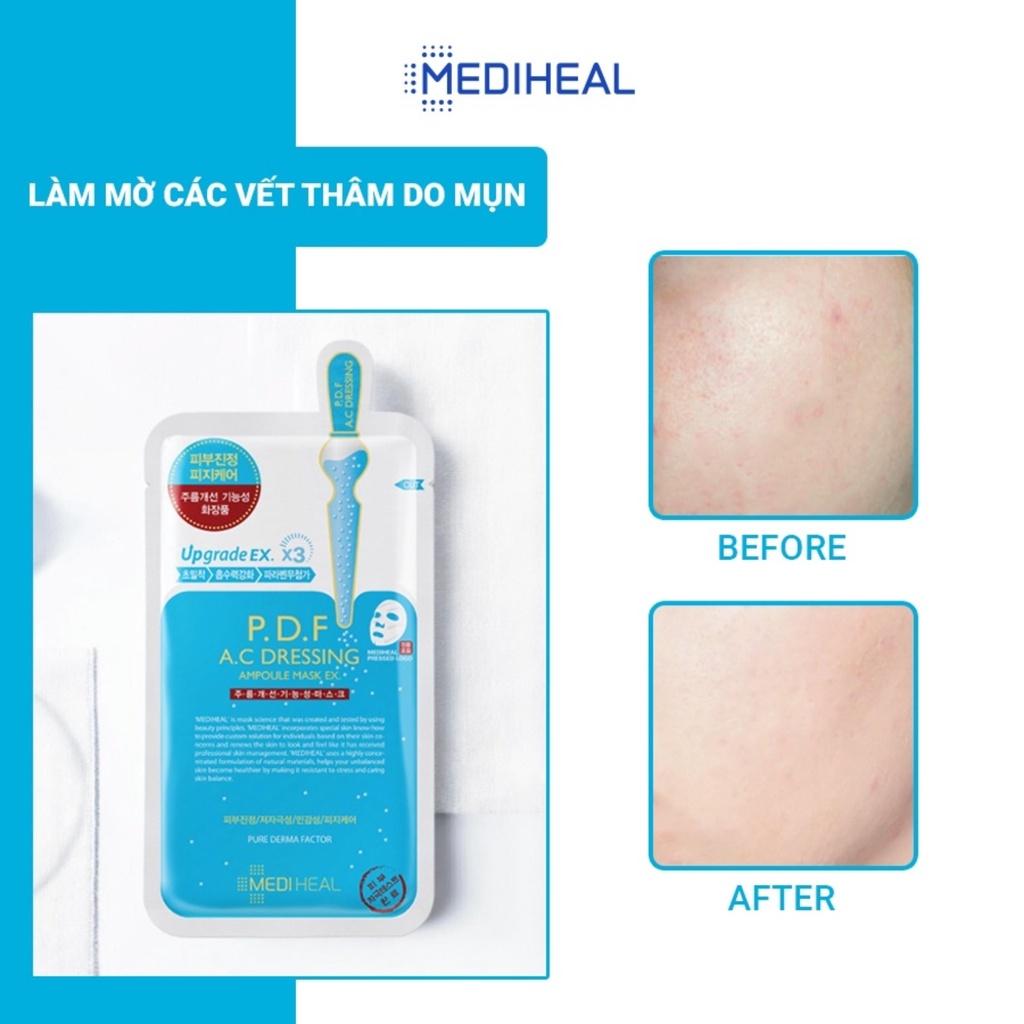 Combo 5 Mặt Nạ Mediheal P.D.F  AC Dressing Ampoule Mask Giảm Mụn Làm Dịu Da 25ml/Miếng