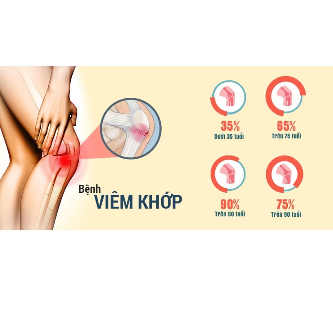 Viên Uống Glucosamine Chondroitin With Msm Giúp Giảm Đau Do Viêm Xương Khớp Hộp 100 Viên