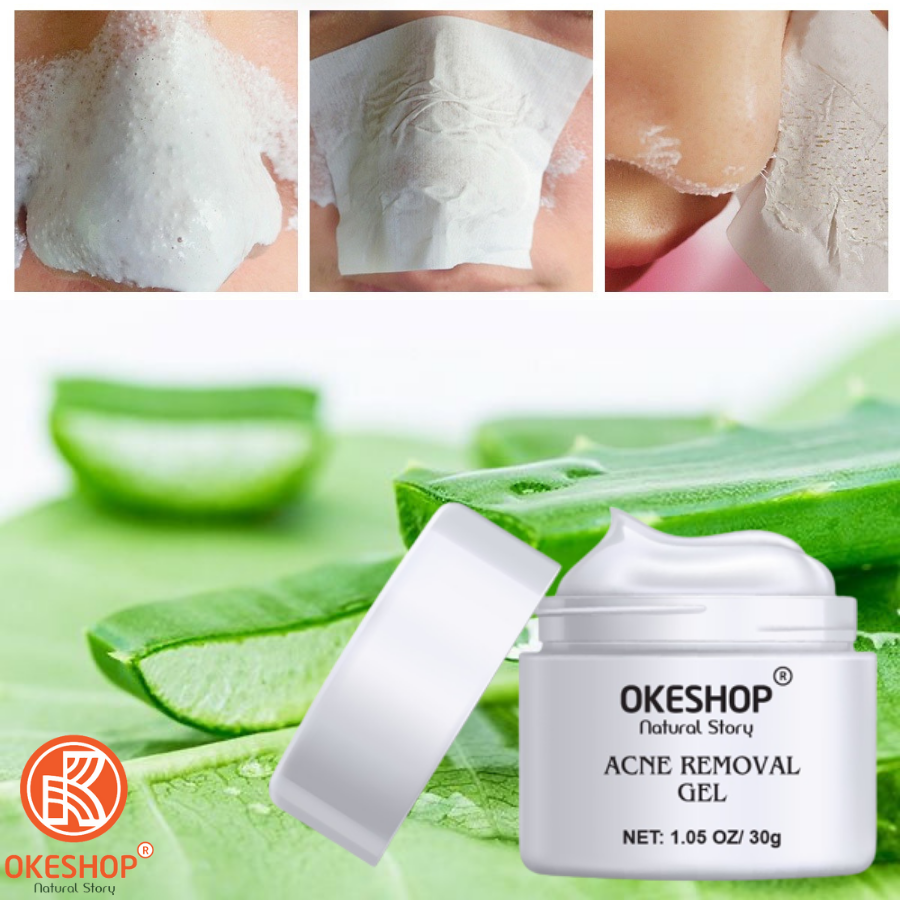 Gel Lột Mụn Nha Đam OKESHOP 30ml - Giải Pháp Loại Bỏ Mụn Đầu Đen - Mụn Cám - Bạ Nhờn - Làm Sạch Sâu Và Thu Nhỏ Lỗ Chân Lông