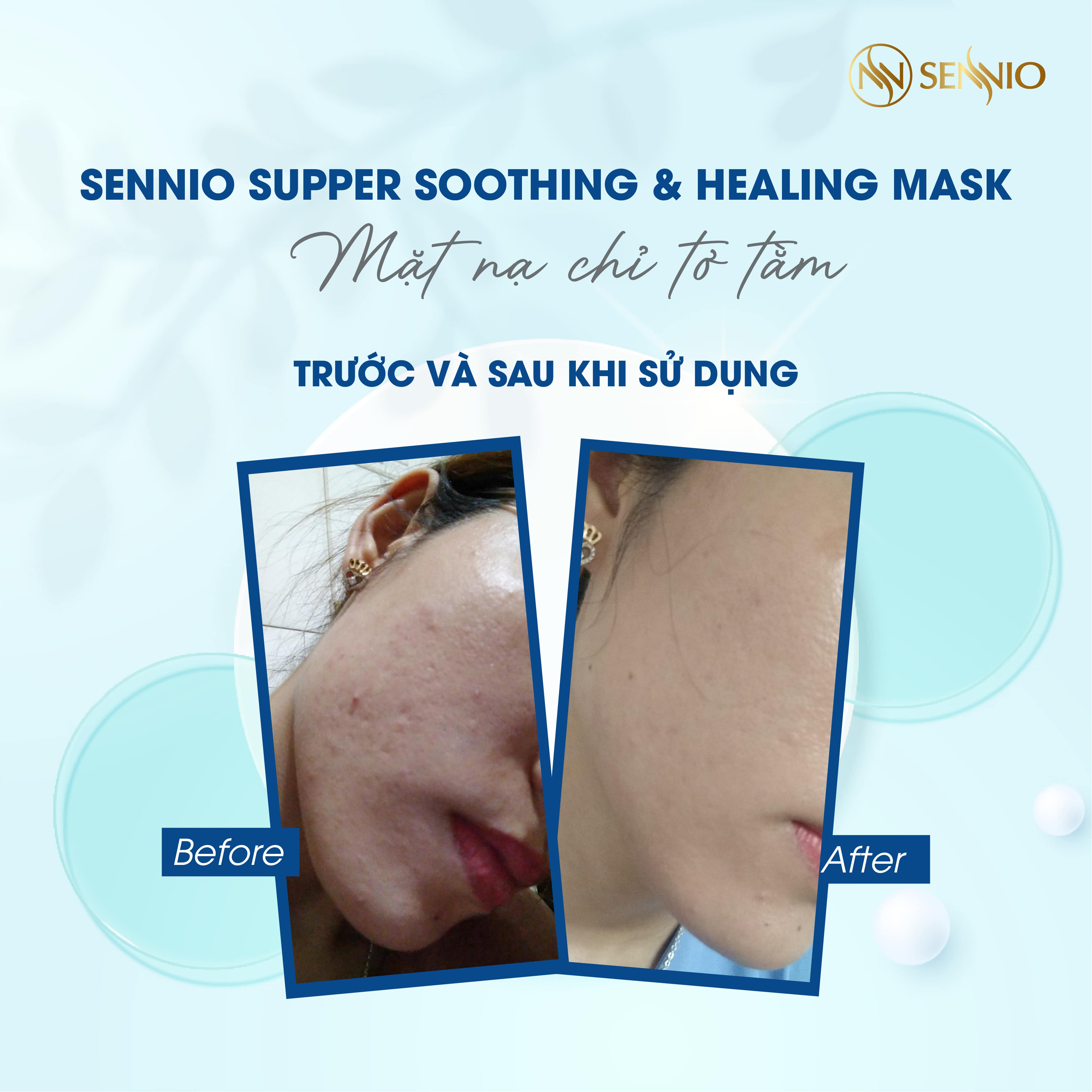 Mặt nạ giấy dưỡng trắng da Sennio Super Soothing &amp; Healing Mask dưỡng ẩm, phục hồi da 23 ml SNO 822