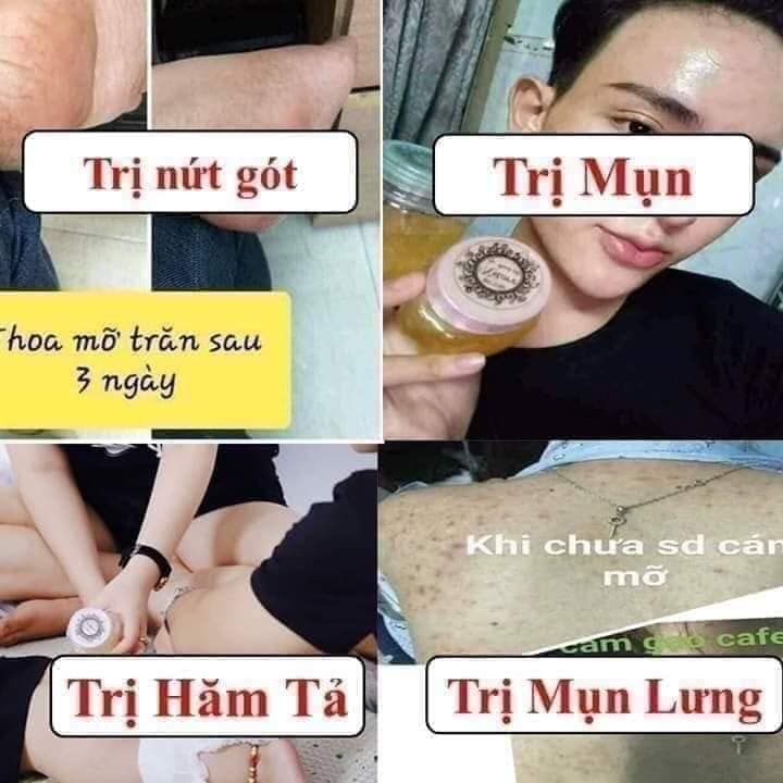 Hình ảnh Mỡ Trăn N'store Nguyên Chất Triệt Lông Vĩnh Viễn, Giảm Bỏng Da, Dưỡng Da, Ngăn Ngừa Rạn Nứt Da (1 Chai 100ML)