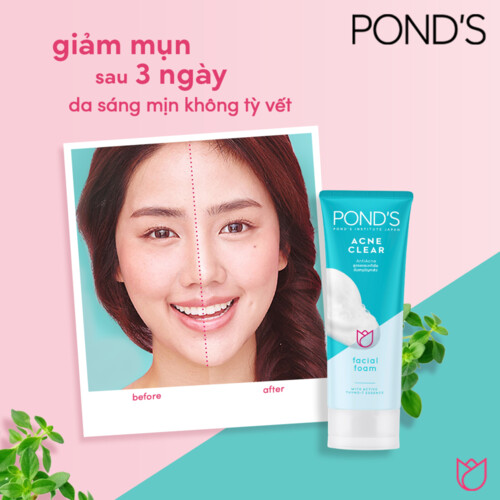 Sữa rửa mặt cho da mụn POND'S tích hợp công nghệ micro foam ngừa mụn sạch sâu sáng da 100g