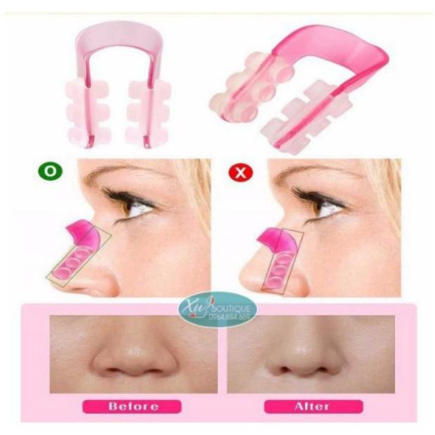 Kẹp nâng mũi Nose Up - Tự nhiên và an toàn