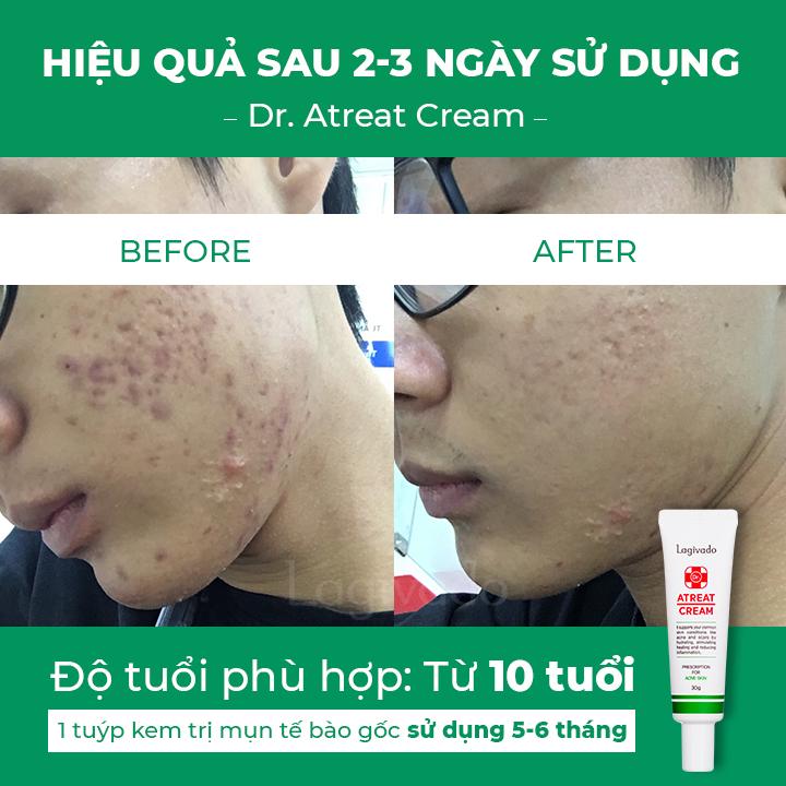 Kem chấm giảm mụn Hàn Quốc Lagivado ngừa thâm sẹo rỗ, thông thoáng lỗ chân lông Dr. Atreat Cream 30 ml