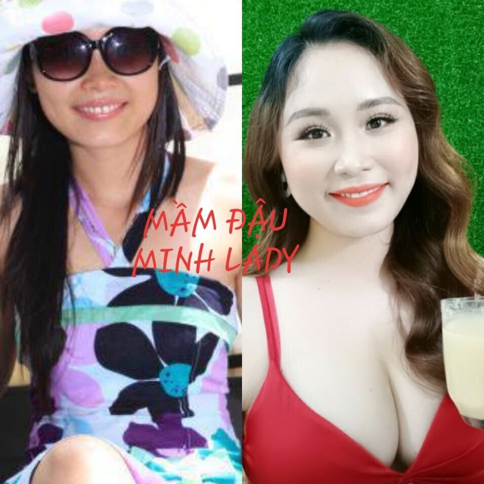 COMBO 4 Mầm Đậu Nành Tăng Vòng 1 Minh Lady Beauty tặng 1 Bịch kẹo Mầm Diệp Lục Colagen