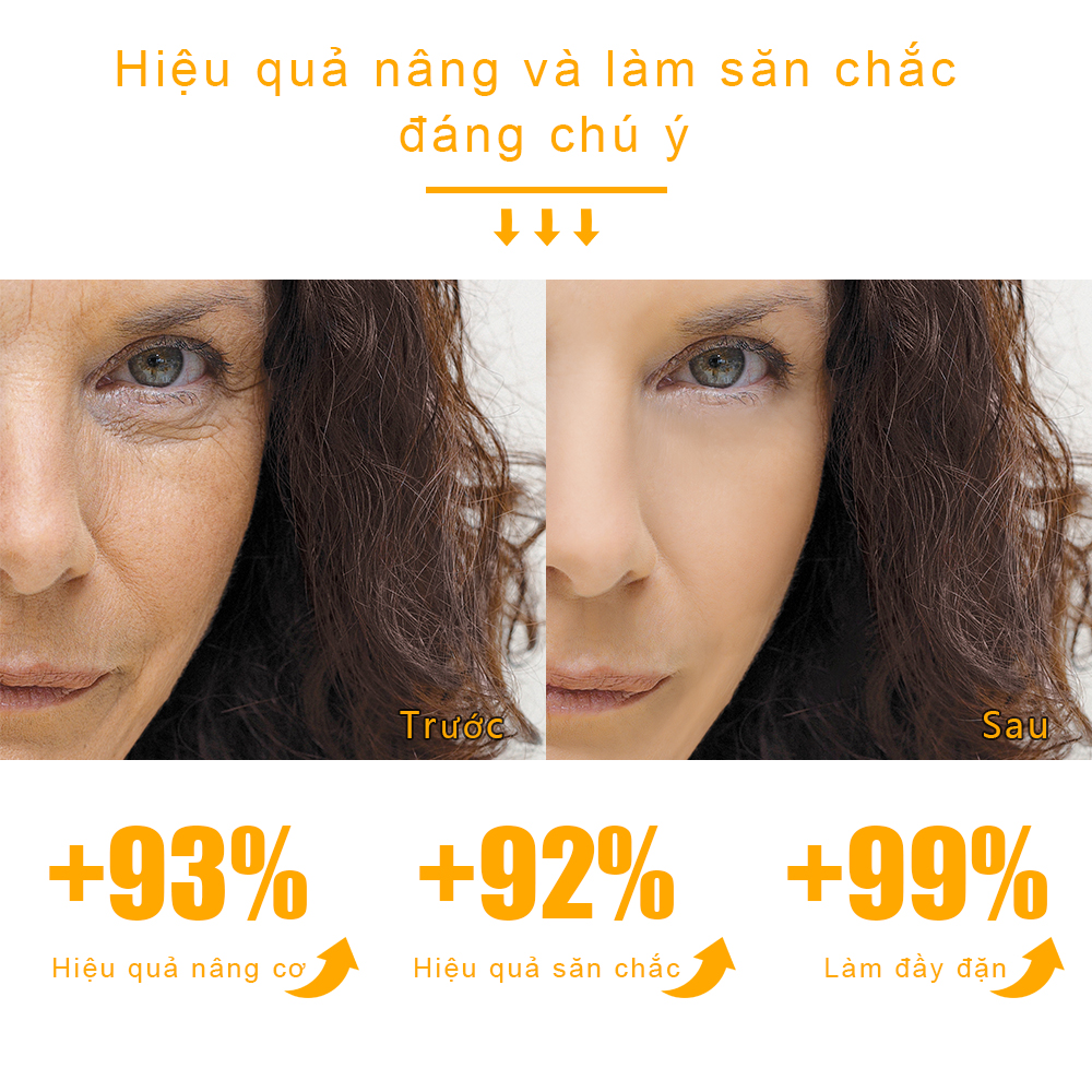 BSKM Tinh Chất Hyaluronic Acid + Hexapeptide Dưỡng Ẩm Chống Oxy Hóa Làm Trắng Chống Nhăn Chống Lão Hóa Làm Trắng Dưỡng Ẩm Bộ