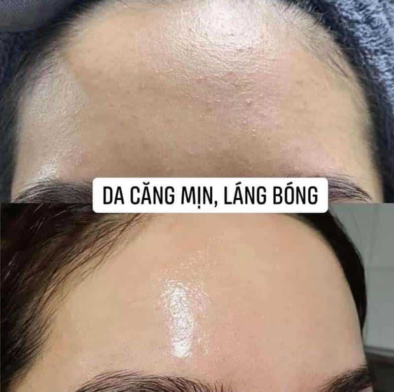 Thay da sinh học trắng sáng da &amp; căng bóng da Md:prepeel Beta&amp;AHAs Complex 15% (50ml)