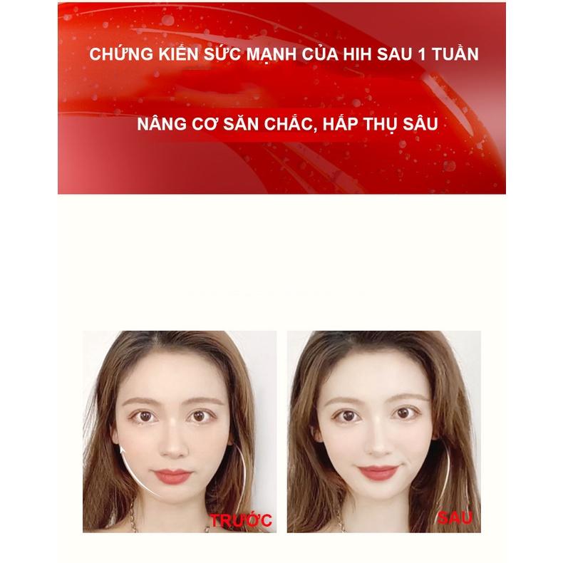 Máy Massage Nâng Cơ Làm Căng Da Mặt HIH