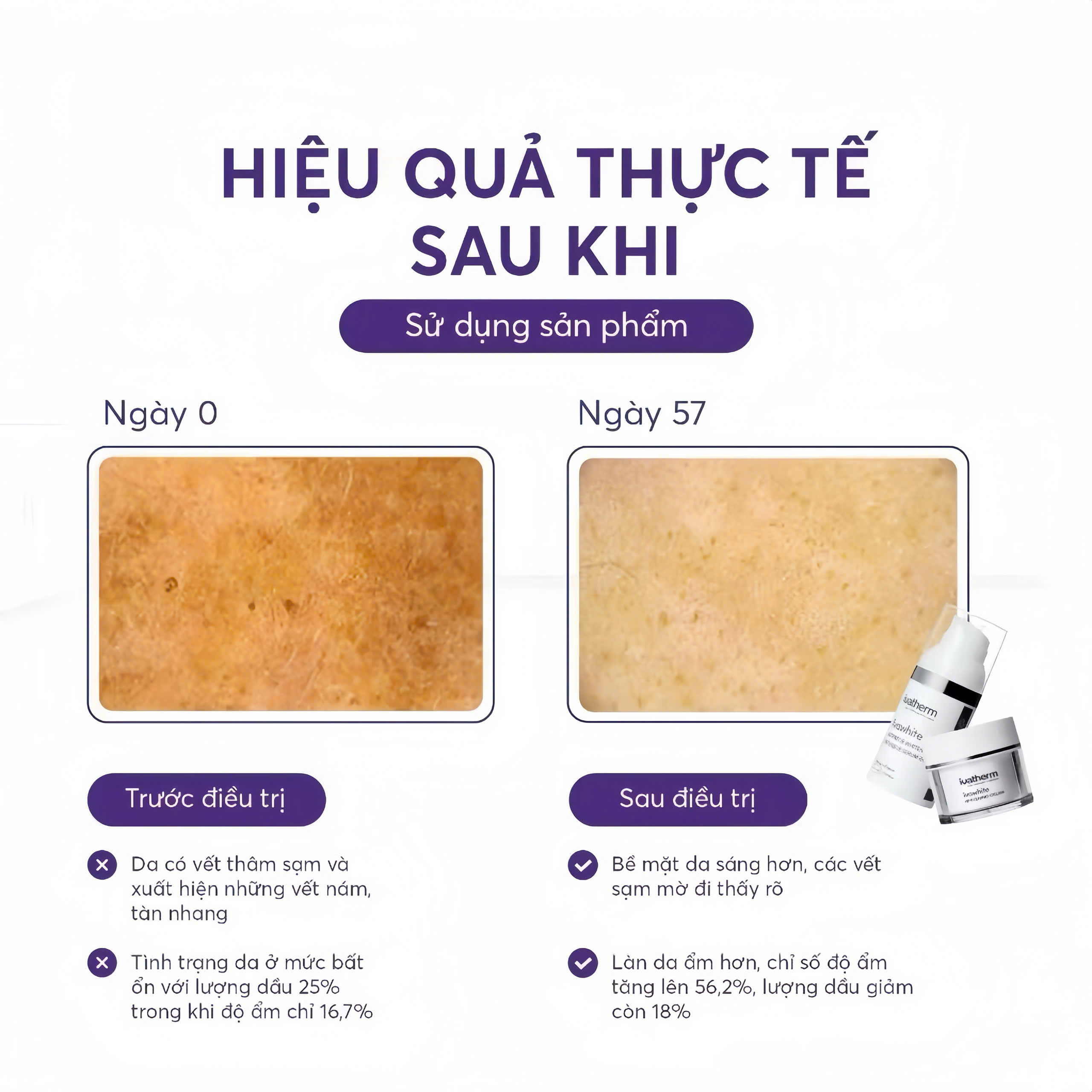 Kem dưỡng giảm nám sáng da Ivawhite Whitening Cream – Ivatherm 50ml