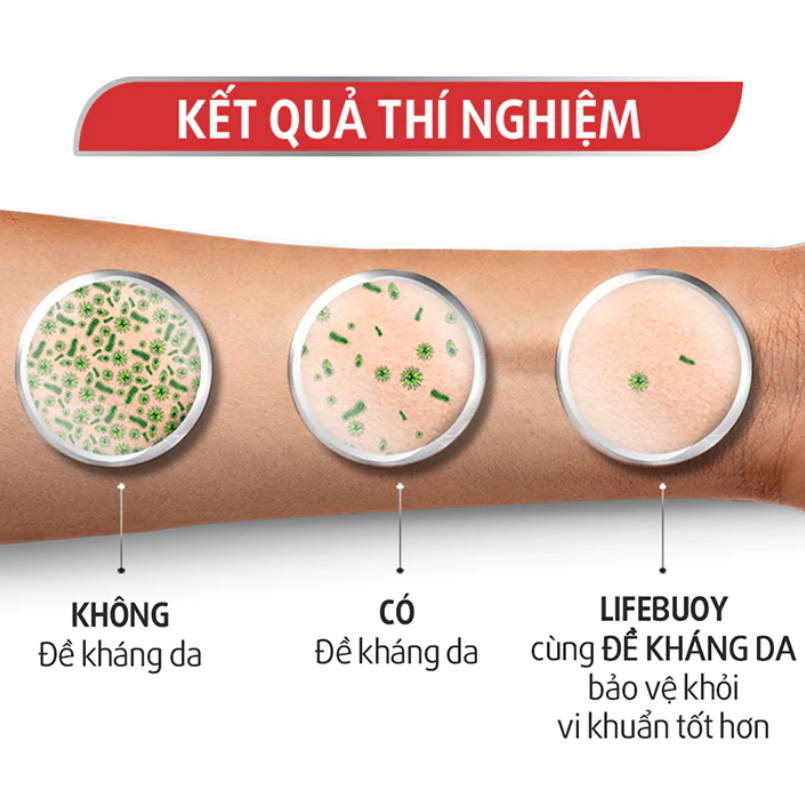 Sữa Tắm Lifebuoy Sạch Khuẩn Khỏi 99.9% Vi Khuẩn Gây Bệnh Chăm Sóc Da Với Ion Bạc+ Hỗ Trợ Đề Kháng Da Tự Nhiên Chai 1kg