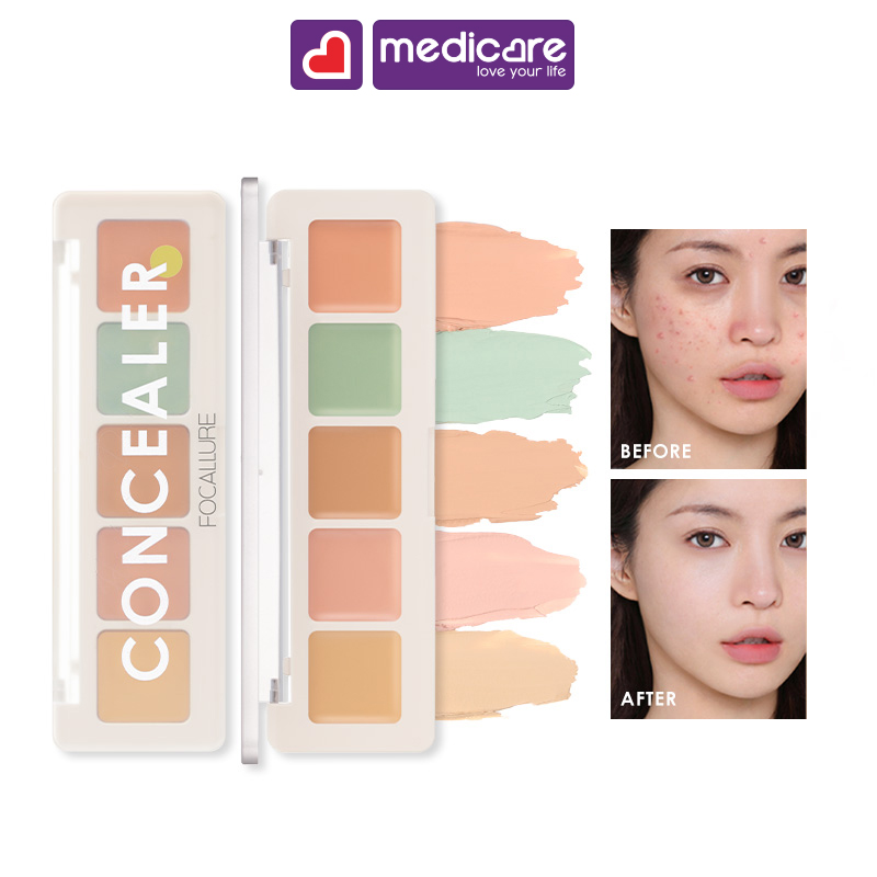 Che khuyết điểm FOCALLURE 5 màu color concealer paletter 4.3g