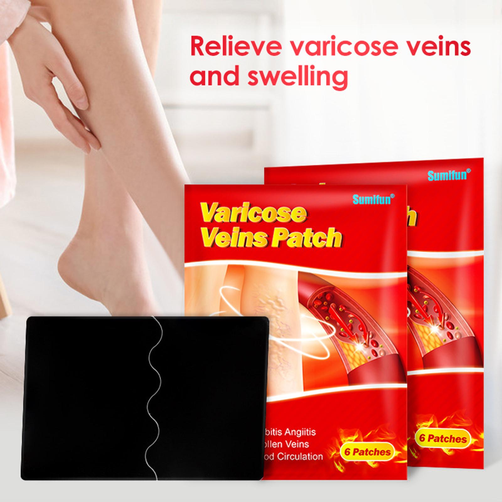 Vein ointment patch Vein curvature posting ointment patch for external use on legs