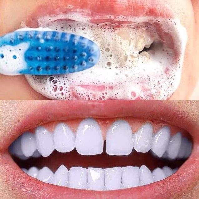 HANG HOT!! Kem đánh răng Baking soda toothpaste giúp răng chắc khỏe sáng bóng (Gia dụng tiện ích 102