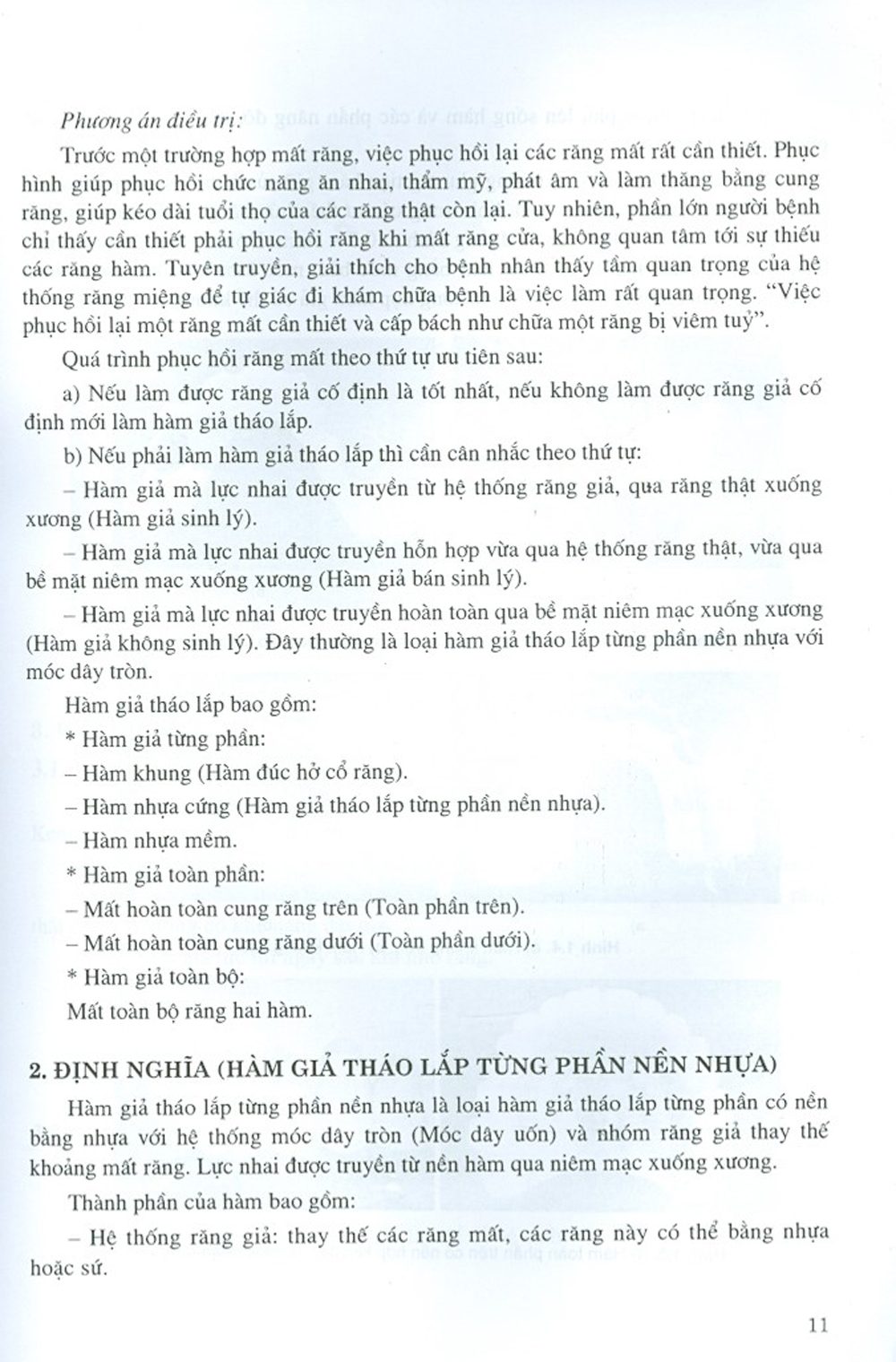 Phục Hình Răng Tháo Lắp (Dùng Cho Sinh Viên Răng Hàm Mặt) - bản in năm 2018