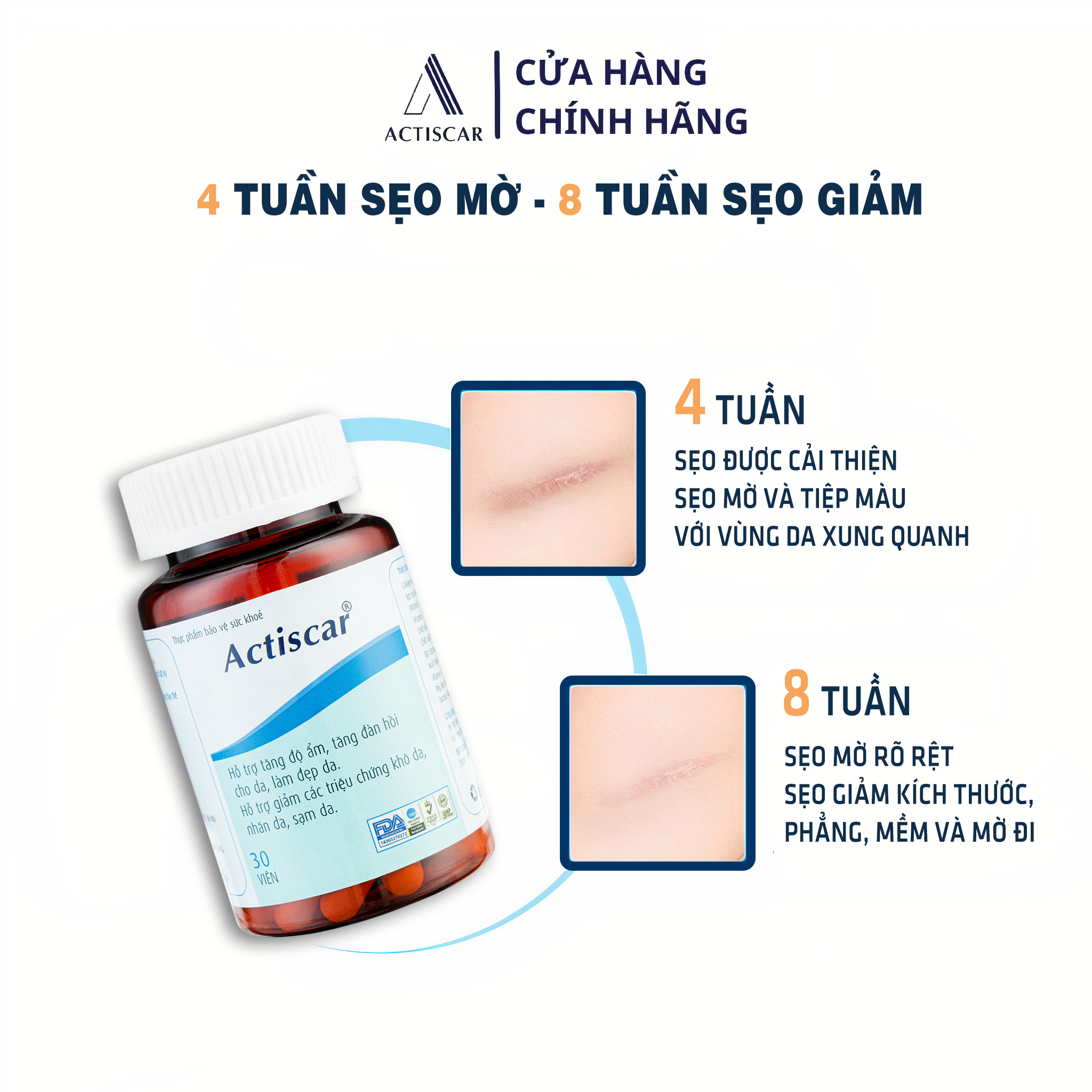 Viên Uống Làm Mờ Sẹo Actiscar Xóa Sẹo Thâm Lồi, Lõm, Bỏng Bô, Thủy Đậu, Sẹo thâm mụn lâu năm