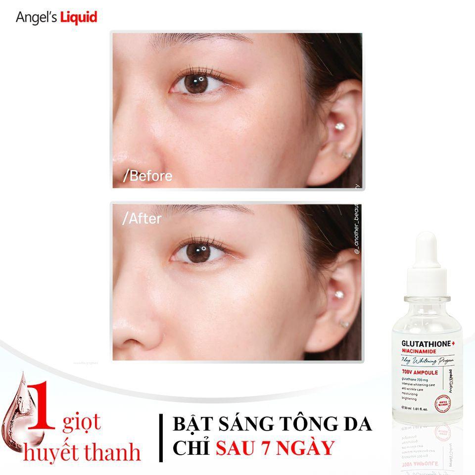 Bộ 3 Angel's Liquid Sản Phẩm Dưỡng Trắng Da Mờ Thâm Nám Glutathione700 (TN 150ml &amp; SR +Niacinamide 30ml &amp; Kem Đêm 50ml)