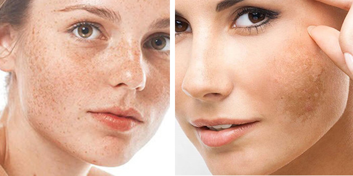 tao sam, thuc pham chuc nang, vien uong dep da