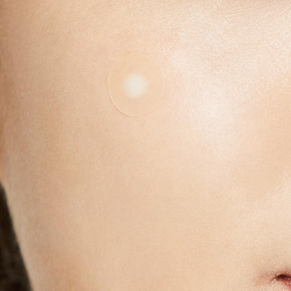 Combo 5 Dán Mụn COSRX Acne Pimple Master Patch