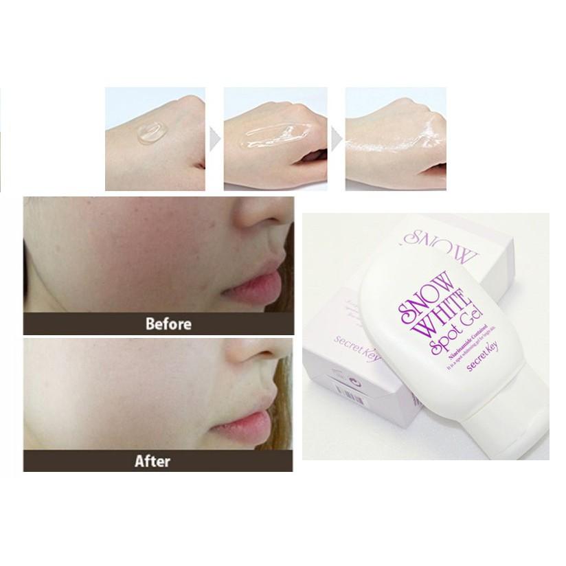 Gel Mờ Thâm, Dưỡng Trắng Cơ Thể Secret Key Snow White Spot Gel 65gr