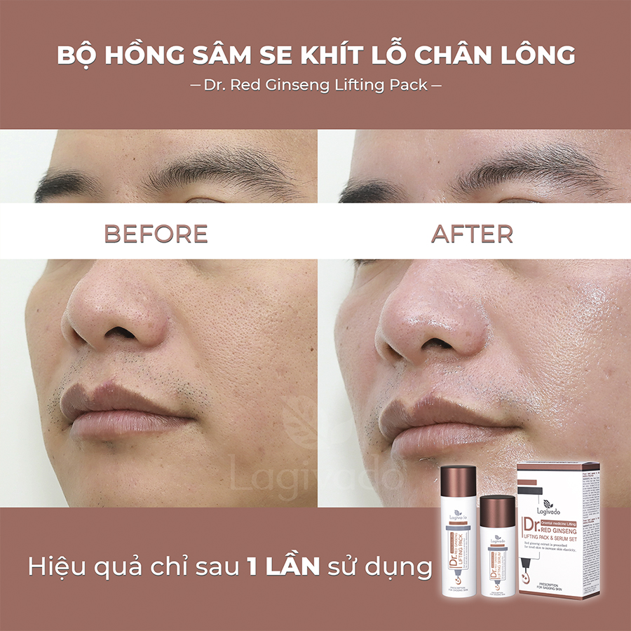 Bộ đôi mặt nạ hồng sâm Hàn Quốc Lagivado thải độc, nâng cơ, đánh bay mụn đầu đen Dr. Red Ginseng Lifting Pack 30 ml và Serum dưỡng da, se khít lỗ chân lông 50 ml