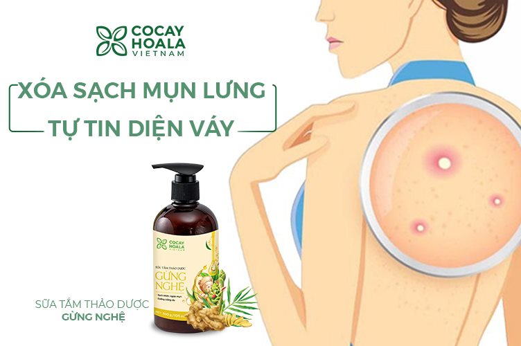 Combo 2 chai sữa tắm thảo dược gừng nghệ COCAYHOALA mờ thâm, ngăn ngừa mụn lưng, viêm lỗ chân lông, đặc biệt an toàn cho da nhạy cảm - Tặng ngay Xà bông dừa tẩy tế bào chết Coboté