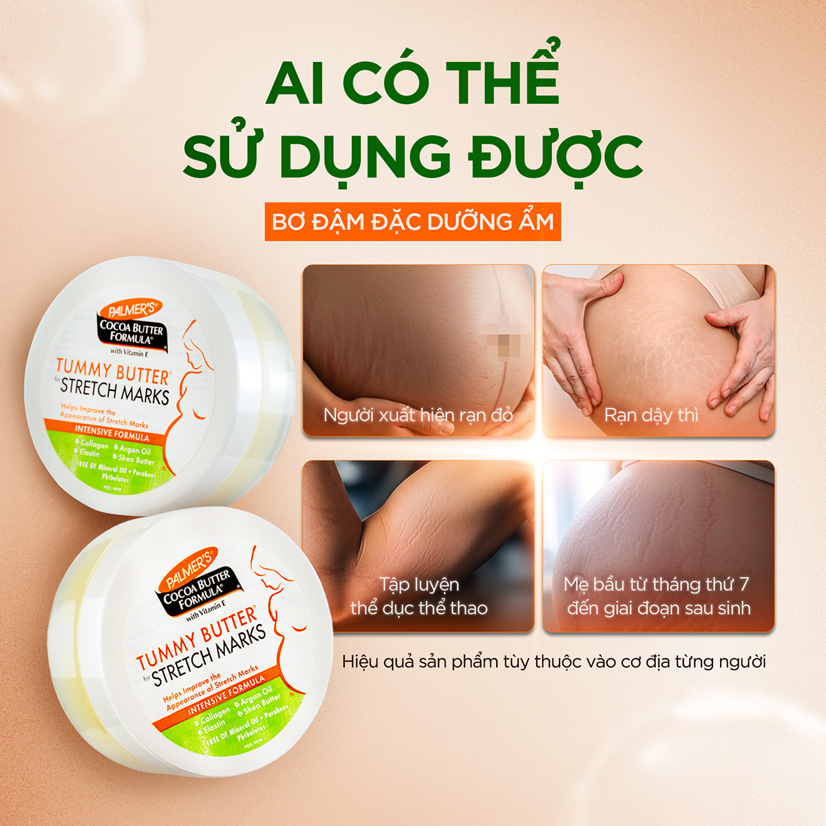 Bơ dưỡng ẩm rạn da cuối thai kỳ Palmer's 125g