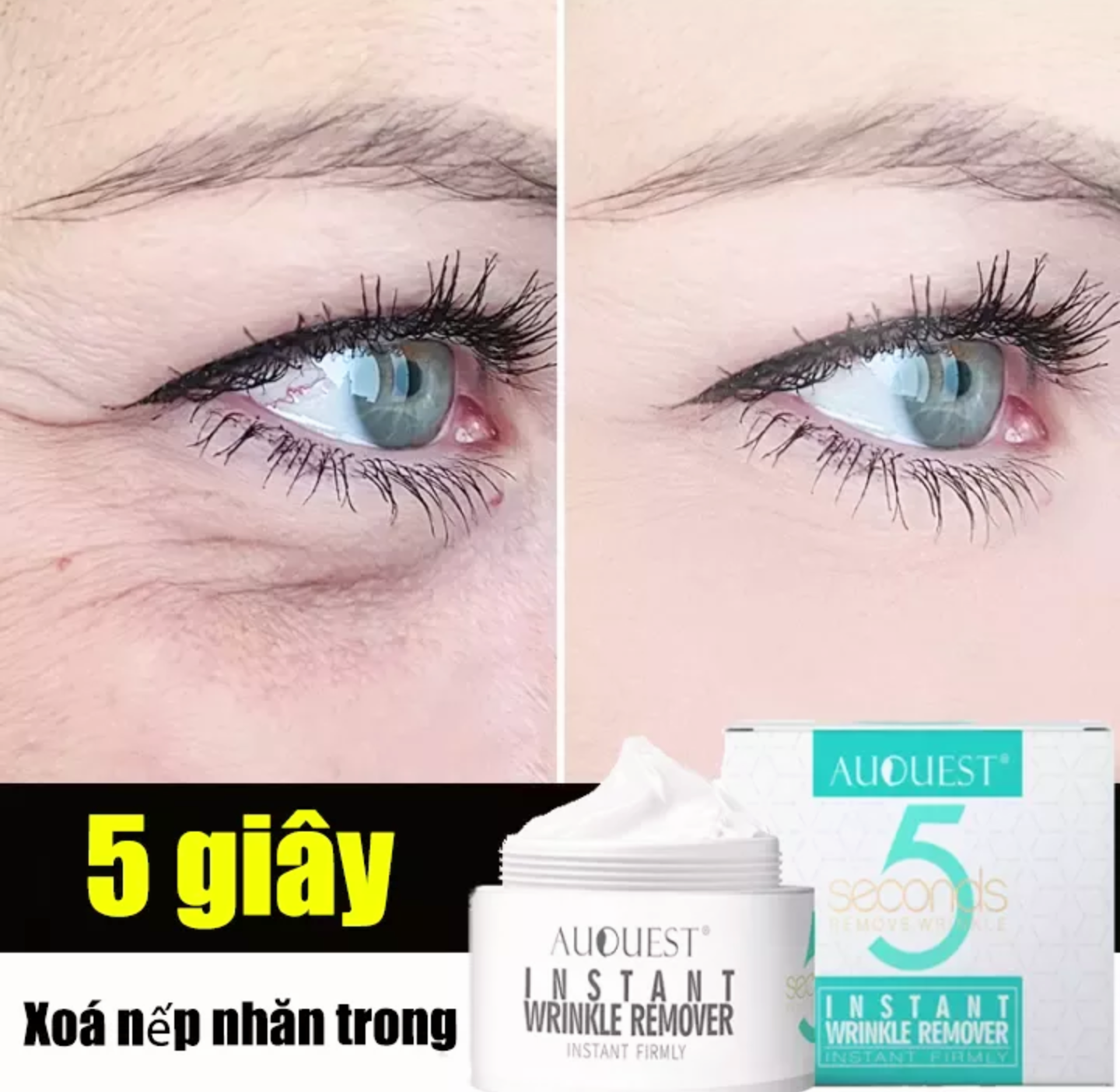 KEM XÓA NẾP NHĂN 5 GIÂY LOẠI BỎ QUẦNG THÂM CHỐNG LÃO HÓA SĂN CHẮC DƯỠNG ẨM DA MẶT CAM KẾT HIỆU QUẢ HÀNG LOẠI TỐT