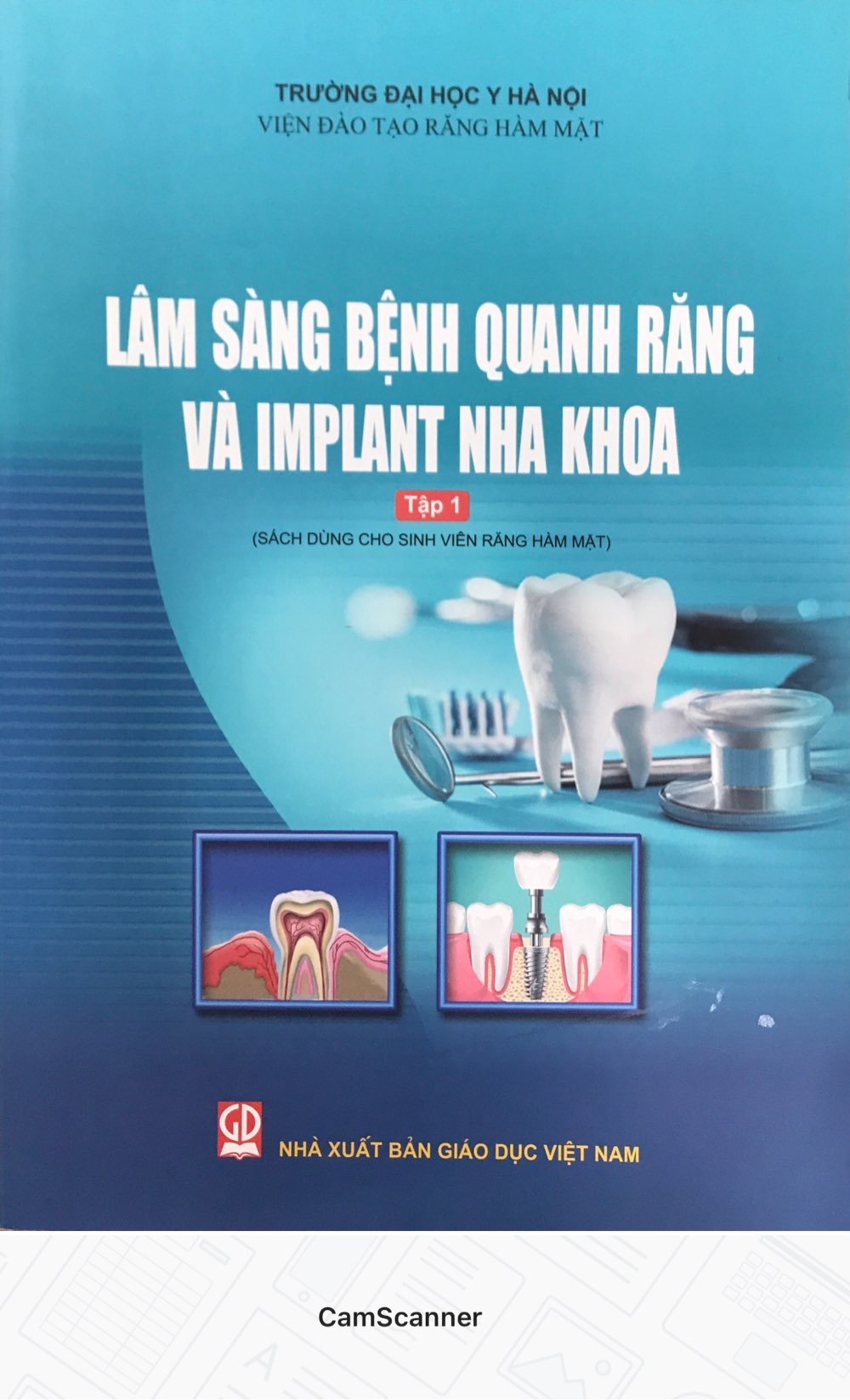 Lâm sàng bệnh quanh răng vầ Implant nha khoa tập 1