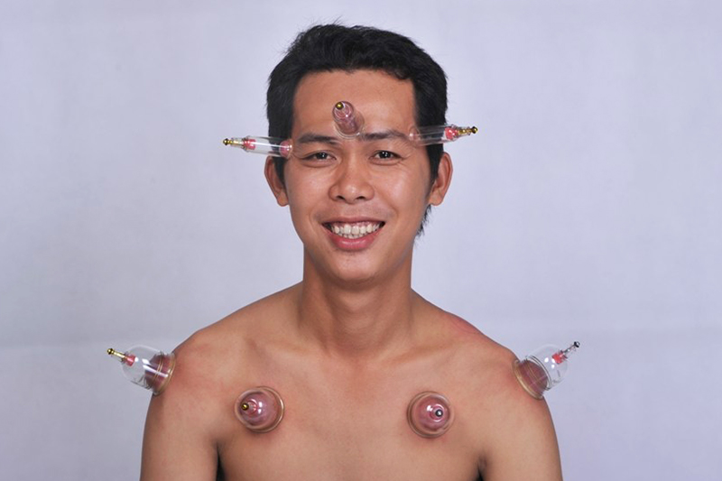 Bộ Giác Hơi Không Dùng Lửa Duy Thành YGH05