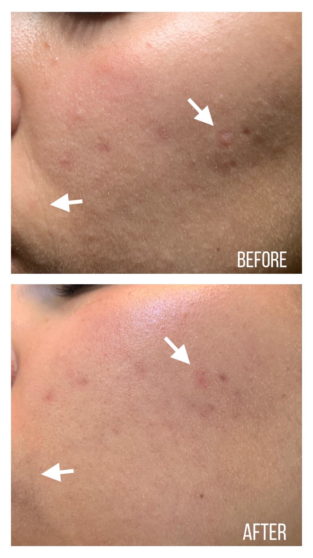 Tinh Chất Atiso Chống Oxy Hóa Tăng Cường Hàng Rào Bảo Vệ Da Axis-Y Artichoke Intensive Skin Barrier Ampoule 30ml