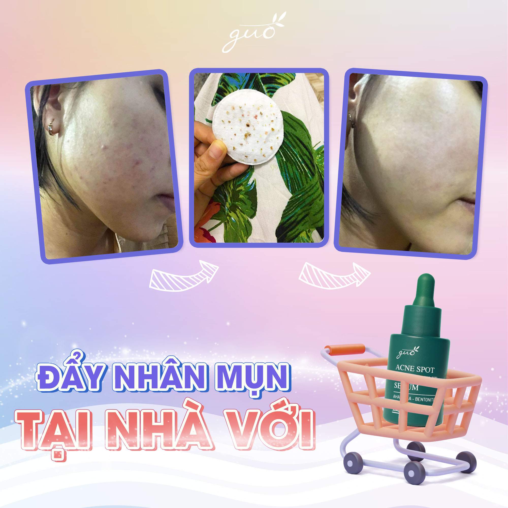 Bộ đôi serum mờ thâm mụn GUO 30ml - [97% feedback khách tin dùng hiệu quả]