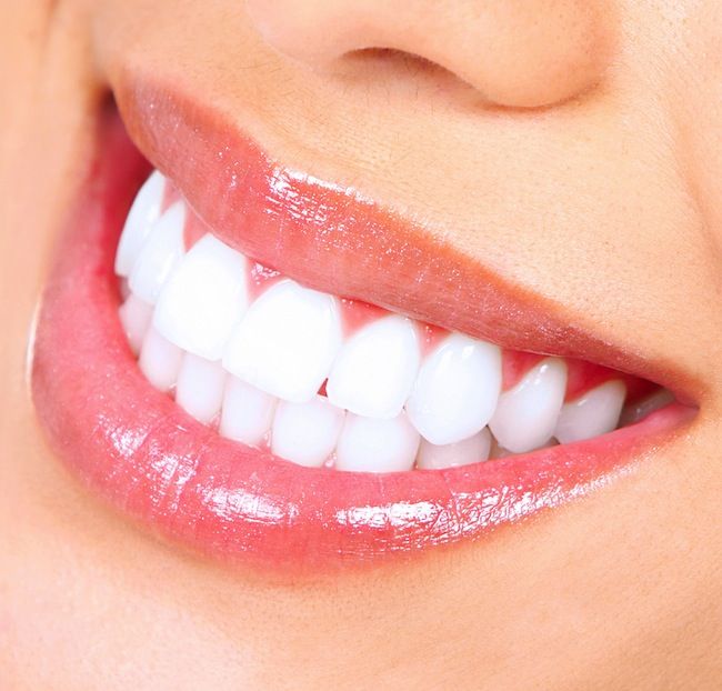 Đính Đá Răng Thẩm Mỹ - Nha Khoa Gia Hân