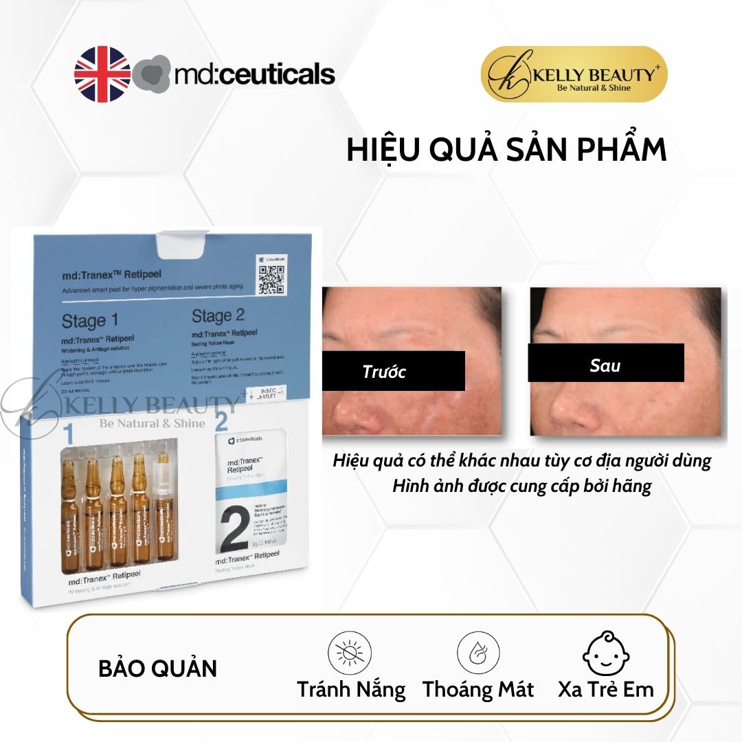 MD:Tranex Retipeel - Peel Sáng Da, Mờ Nám Sạm, Chống Lão Hóa - md:ceuticals | Kelly Beauty