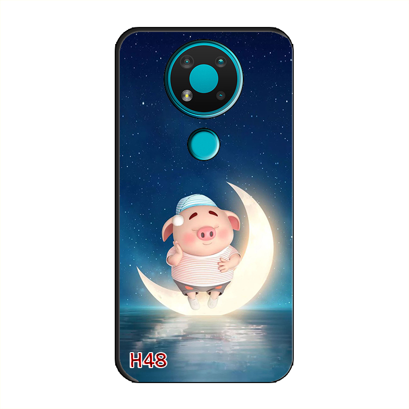 Ốp Dẻo Dành Cho NOKIA 3.4