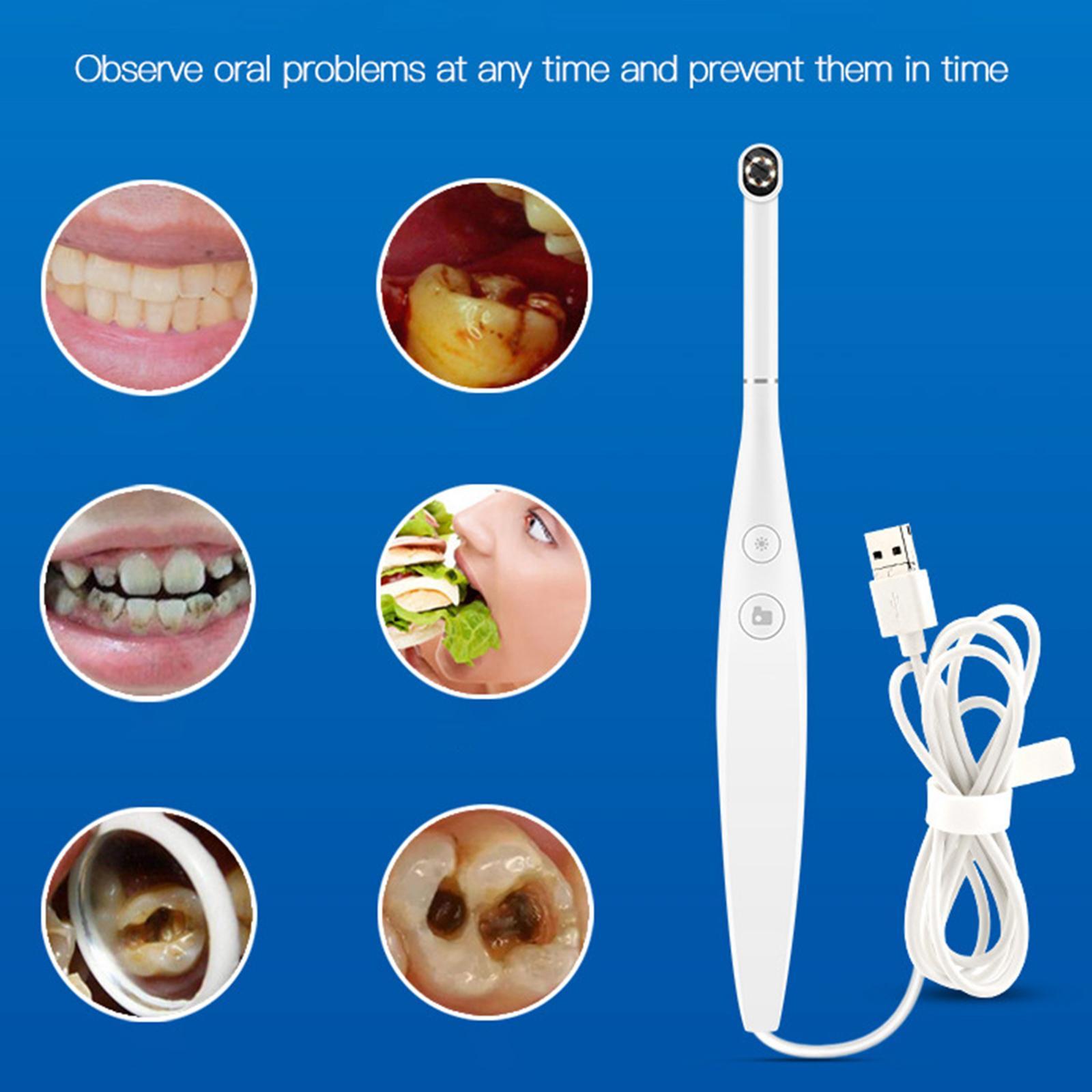 100W  Lens Intraoral  LED Lights Oral Endoscope Detachable USB