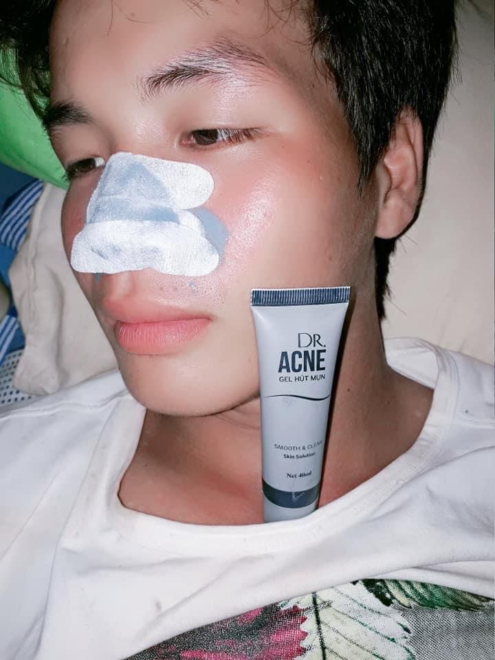 Gel hút mụn tro núi lửa dr.acne tuýp 40ml