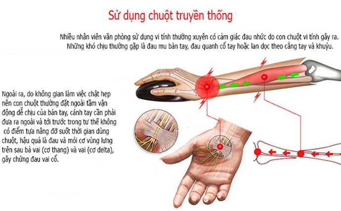Chuột Đứng Không Dây Chính Hãng HXSJ 